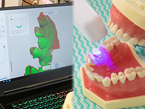 口腔内スキャナー